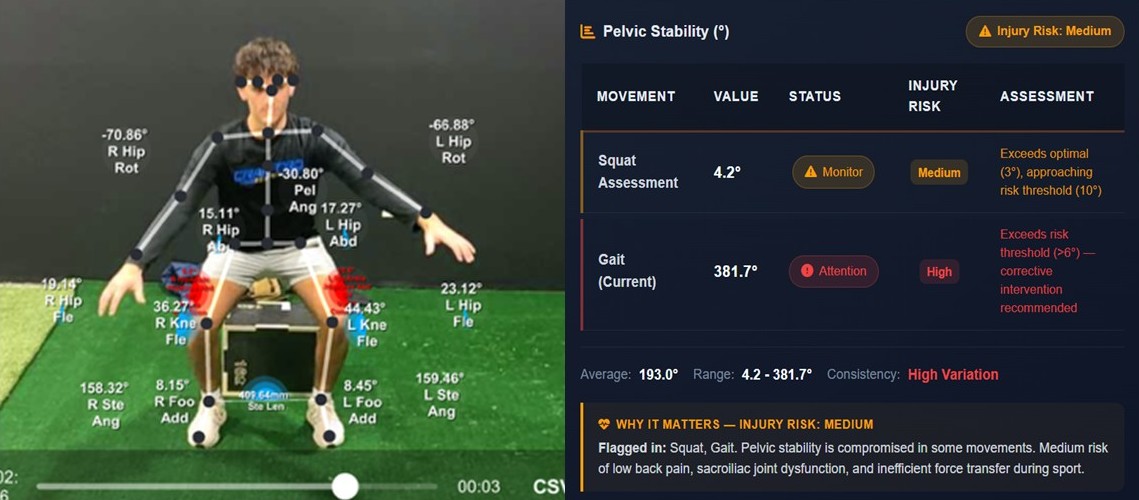 Objective functional movement evaluation showing AI-driven biomechanical analysis