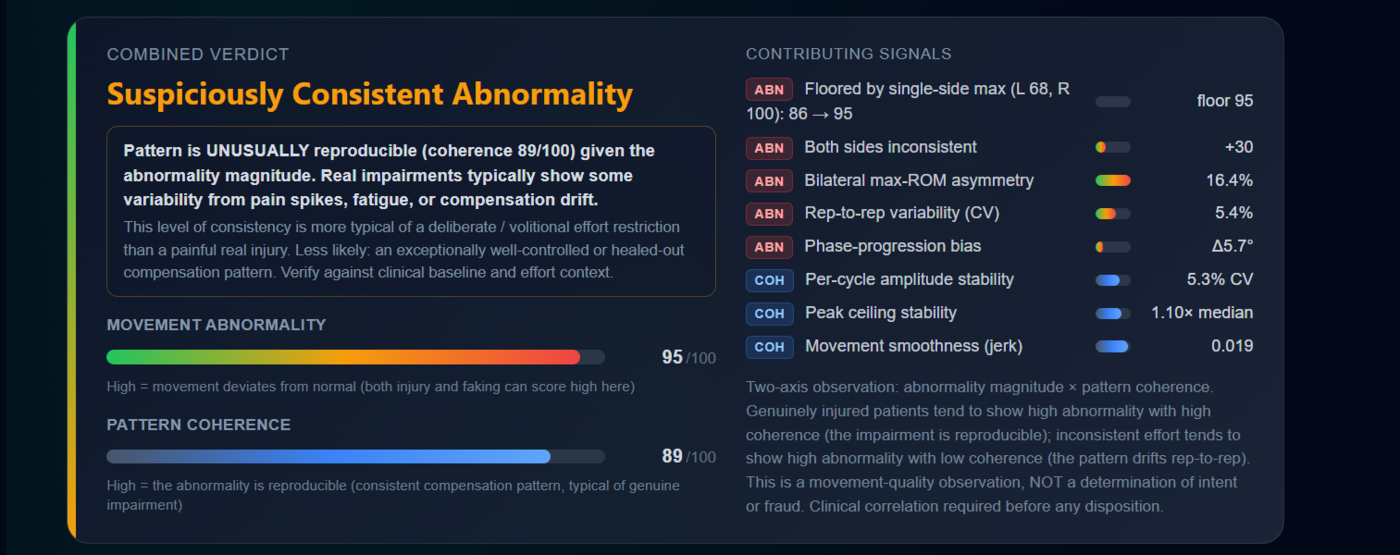 AvaSci movement consistency analysis — abnormality magnitude and pattern coherence signals highlighting results that may warrant additional clinical review